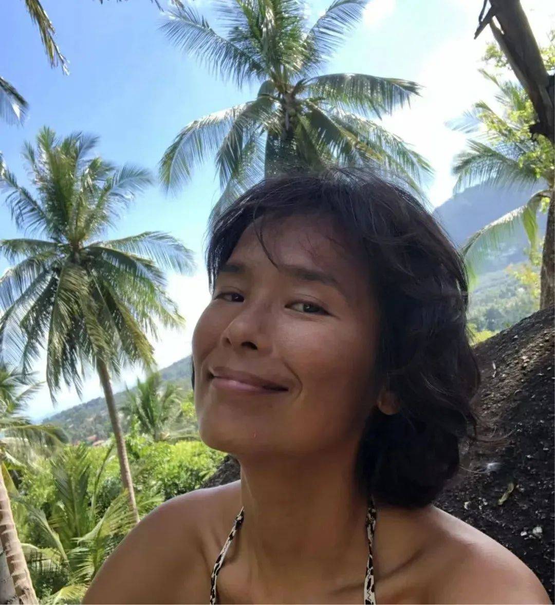 著名歌星自曝遭遇重大车祸，整个脊柱断了！