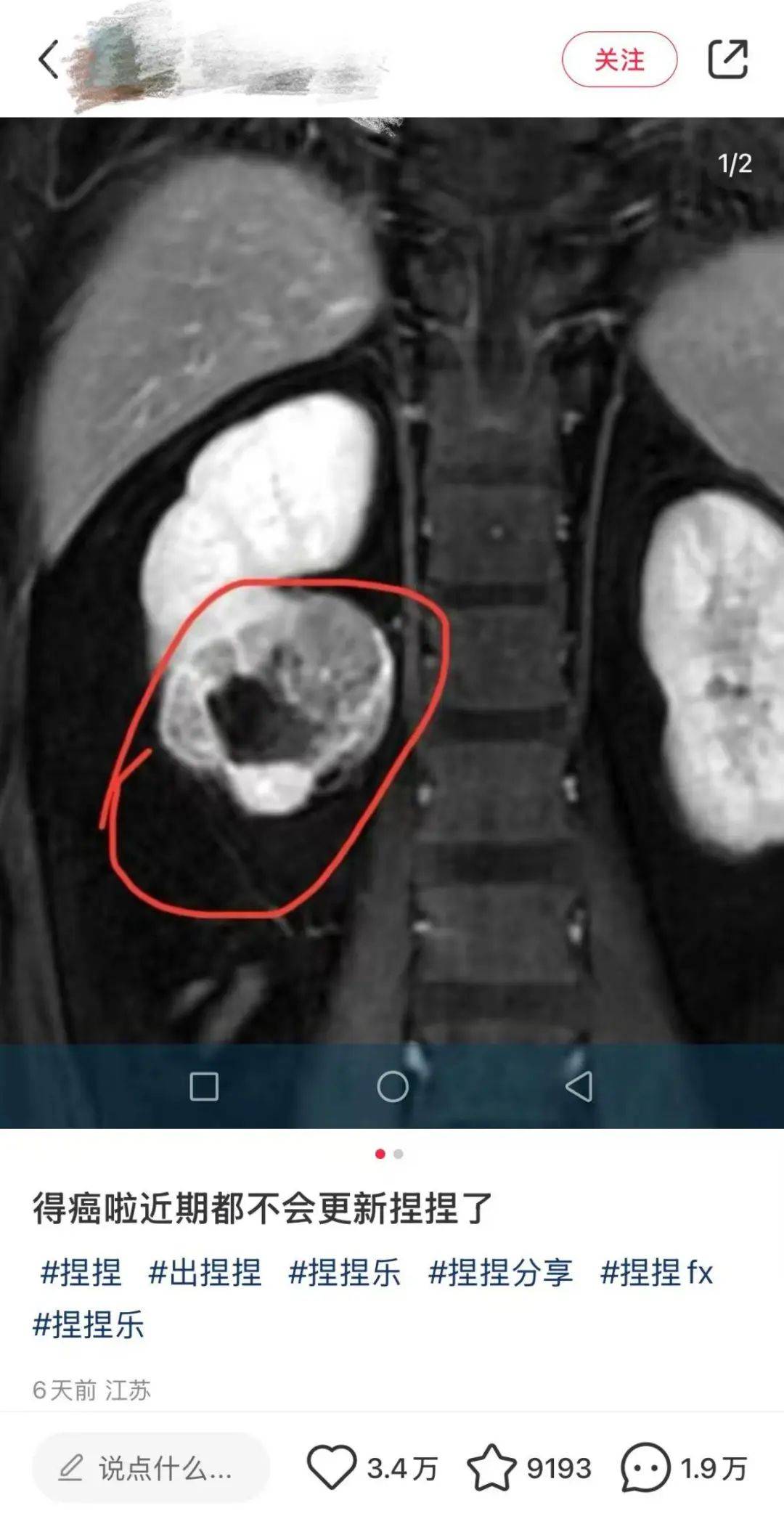 警惕！有毒物质100%超标，这款解压新宠你大概率也买过→