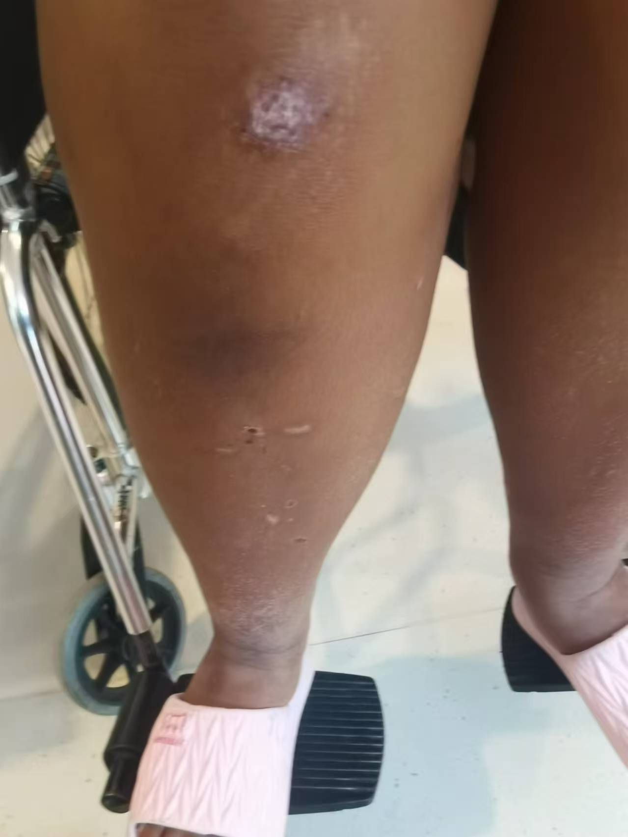 河南中牟14岁女孩拓展营身亡前遭体罚，“班主任”扣留求救信案将再次开庭，家属发声